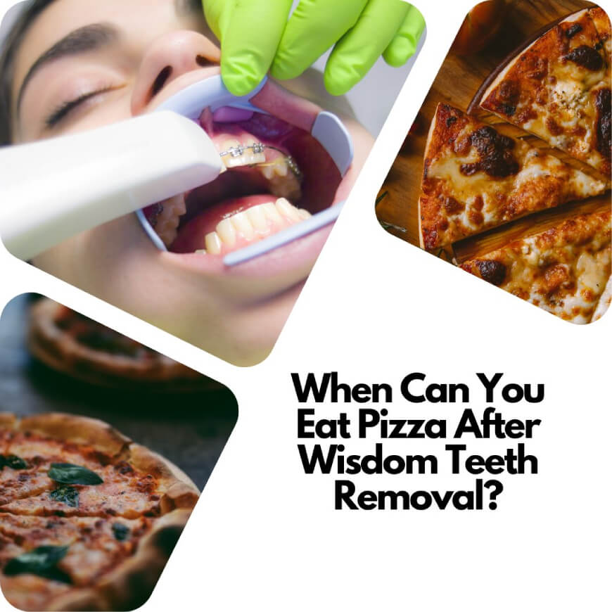 Can You Eat Pizza After Wisdom Teeth Removal